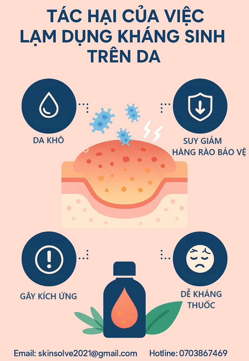 Tạm biệt kháng sinh, chào làn da khỏe mạnh – Cách trị mụn thông minh thời hiện đại