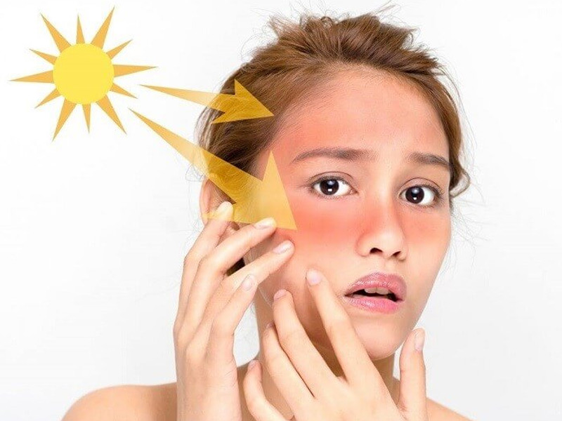 Nám da là gì? Nguyên nhân và cách nhận biết từng loại nám
