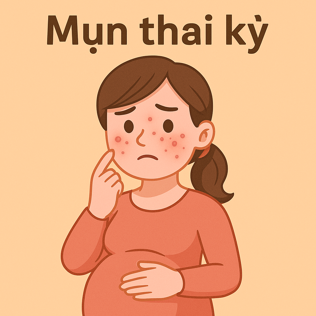 Mụn Thai Kỳ: Cách Xử Lý An Toàn Mà Mẹ Bầu Cần Biết