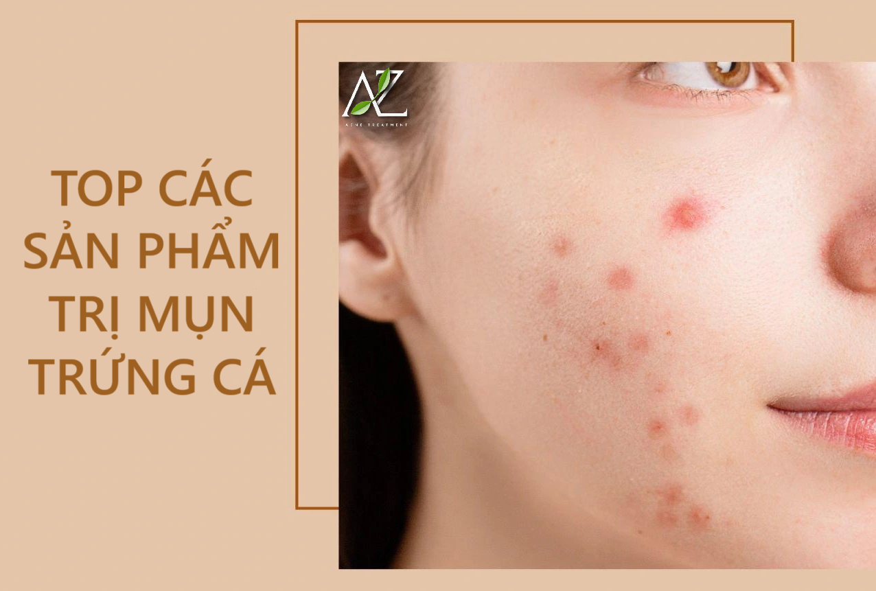 Các sản phẩm trị mụn trứng cá