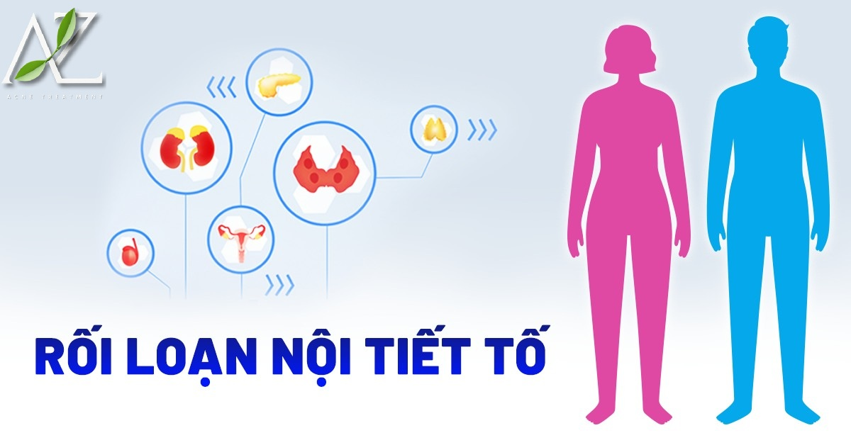Nguyên Nhân Gây Mụn Đầu Đen