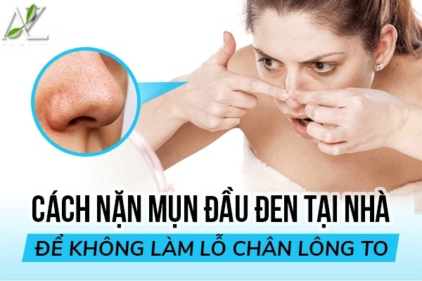 Cách Nặn Mụn Đầu Đen An Toàn Tại Nhà