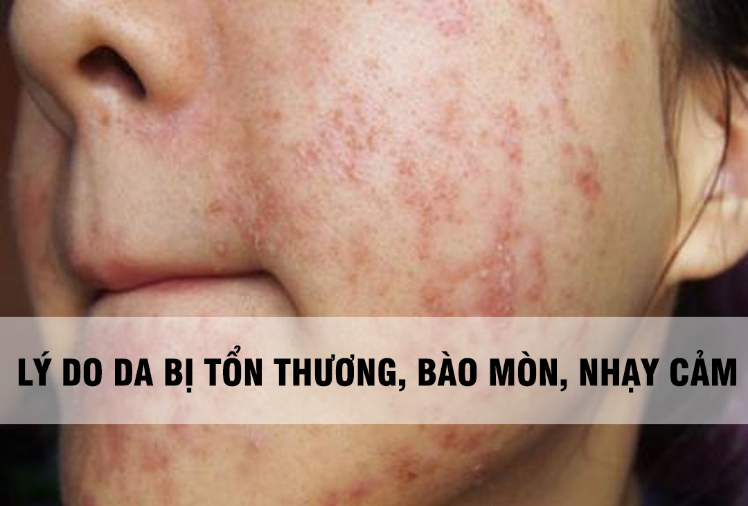 Giữ Da Khỏe, Giữ Thai Kỳ An Toàn
