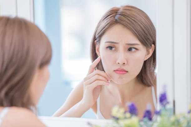 Cẩn Thận: 5 Thói Quen Âm Thầm Khiến Da Bạn Bùng Mụn