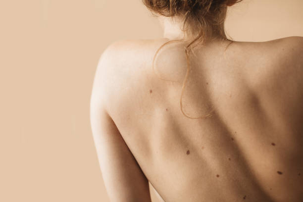 Tạm Biệt Mụn Lưng, Da Body Khô Ráp – Hướng Dẫn Dưỡng Da Cơ Thể Từ A–Z