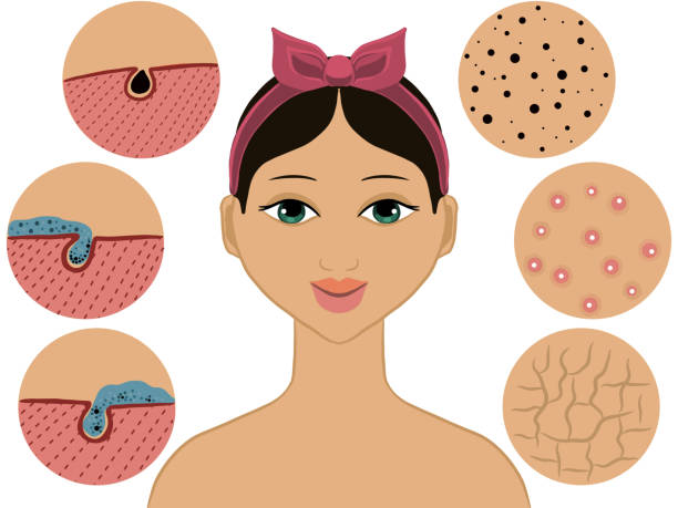 Da Mẩn Đỏ, Ngứa Rát – Đừng Để Thành Vết Thâm Cứng Đầu