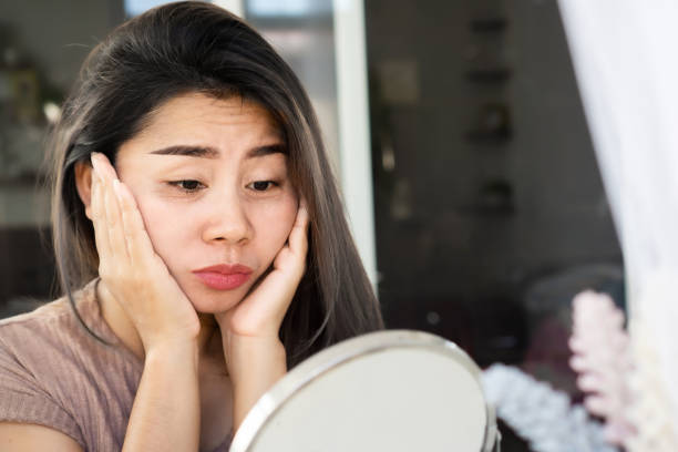 Bí quyết giảm nếp nhăn vùng mắt hiệu quả tại nhà