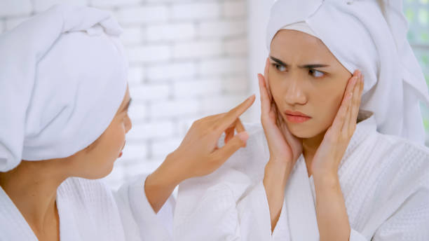 Cẩn Thận: 5 Thói Quen Âm Thầm Khiến Da Bạn Bùng Mụn