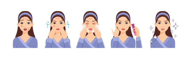 Da dầu mùa hè không còn đáng sợ nếu bạn biết 7 bí kíp kiểm soát bã nhờn này