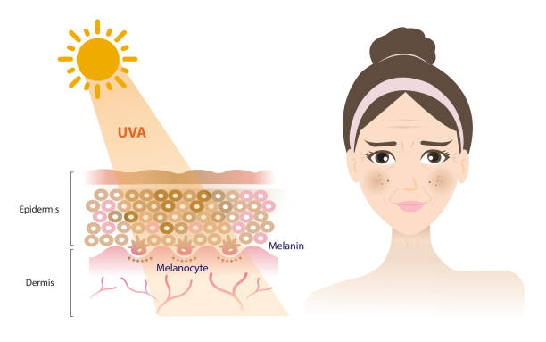 Da sạm vì đâu ? Cách khắc phục triệt để ngay từ gốc