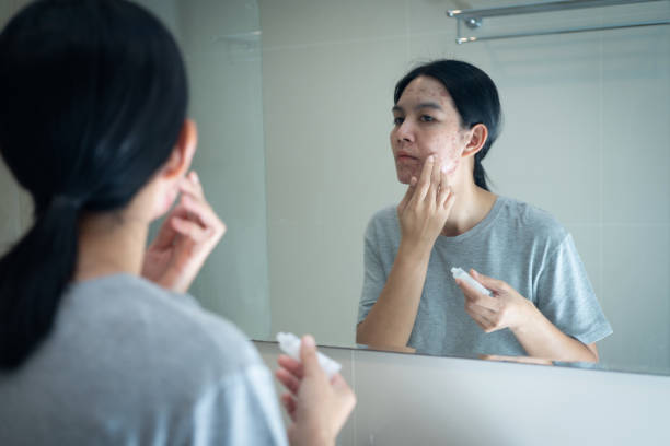 Bí Quyết Chăm Sóc Da Đúng Cách Để Da Luôn Khỏe Đẹp