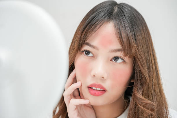 Bảo vệ da mùa hè đúng cách – bạn đã làm đúng chưa ?