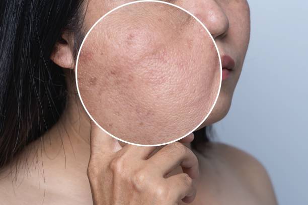 Da hỗn hợp – Khó chiều nhưng không khó chăm nếu bạn biết những điều này