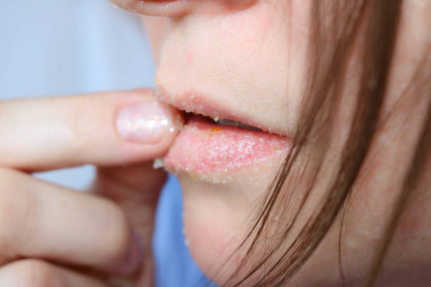 Làn môi hồng hào, không còn bong tróc chỉ nhờ 1 mẹo đơn giản