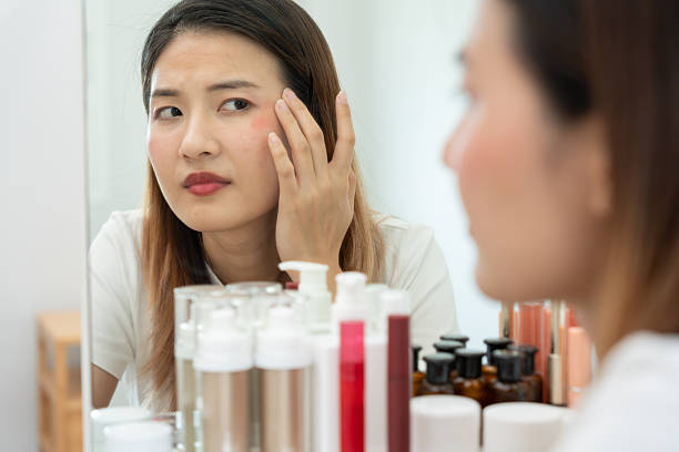 Tại sao da sau sinh dễ bị xỉn màu ?