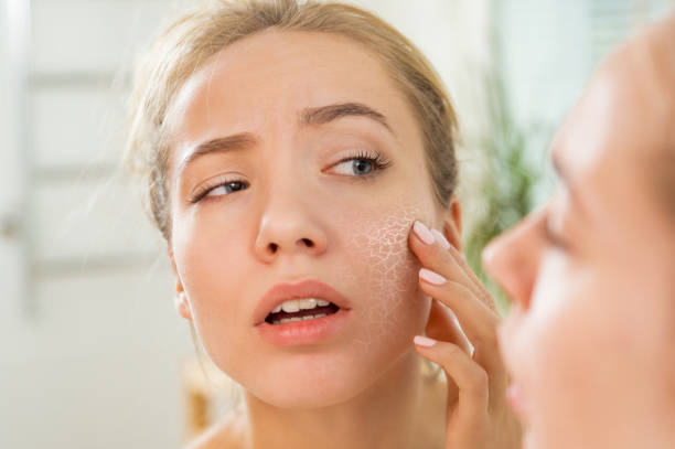 Top sữa rửa mặt dịu nhẹ cho da khô nhạy cảm
