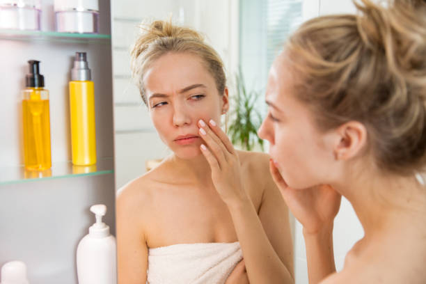 Da Mẩn Đỏ, Ngứa Rát – Đừng Để Thành Vết Thâm Cứng Đầu
