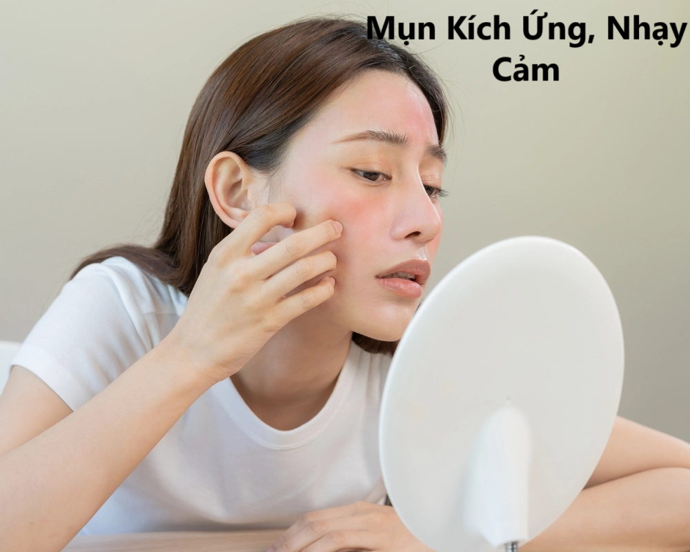 Mụn Kích Ứng, Nhạy Cảm: Nhận Biết Và Xử Lý Đúng Cách Để Tránh Hậu Quả Lâu Dài