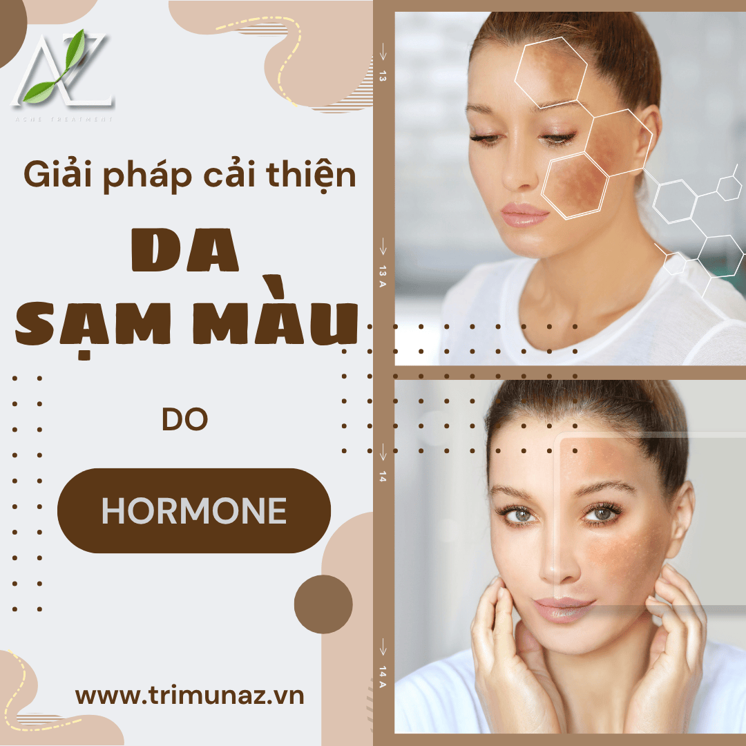 Làm Gì Khi Da Sạm Màu Do Hormone ? Cách Xử Lý Hiệu Quả Được Bác Sĩ Khuyên Dùng