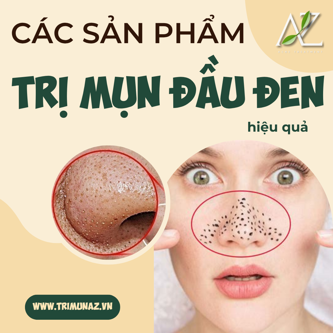Sản Phẩm Trị Mụn Đầu Đen Hiệu Quả